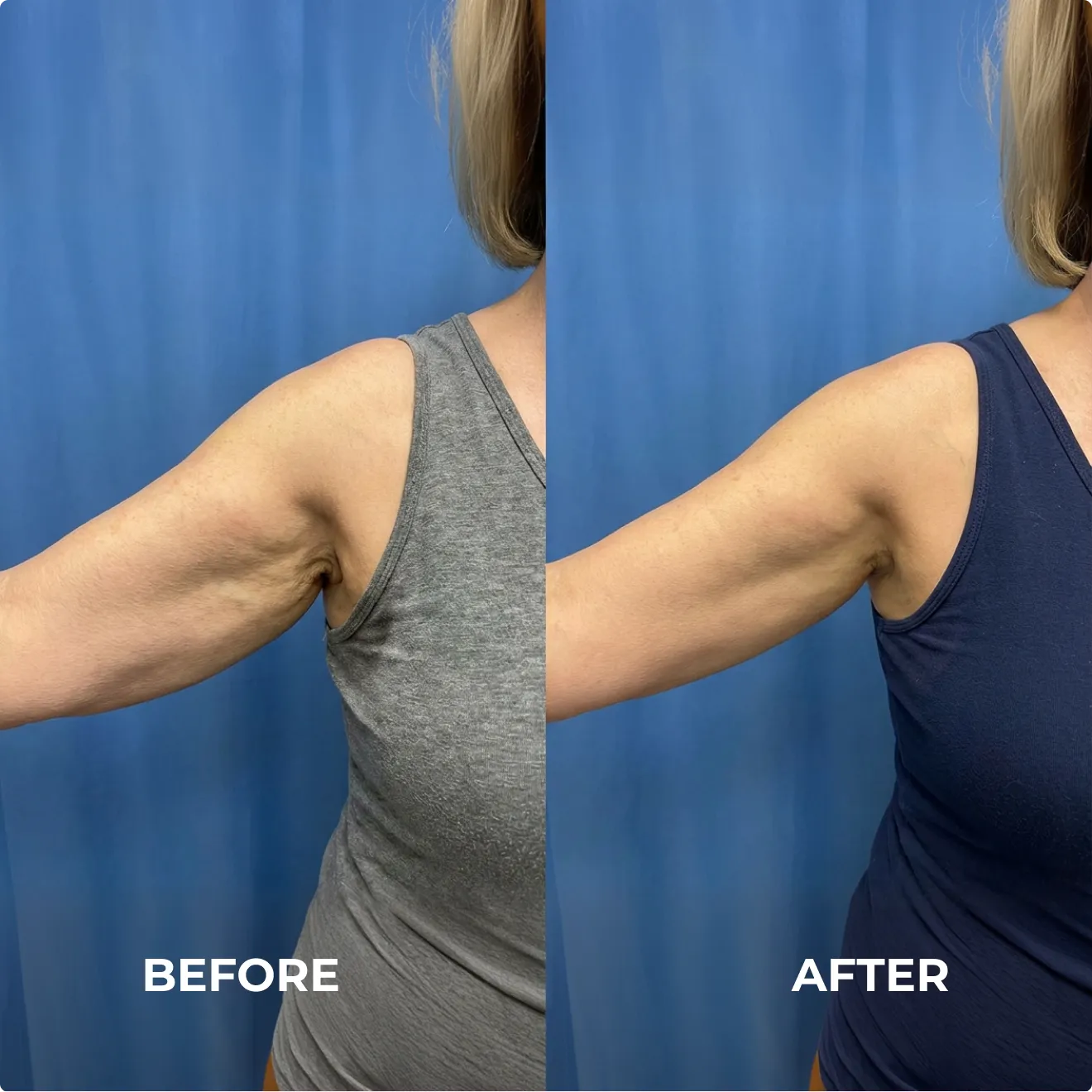 LumiRise® + 1 Collagen Power Boosting Serum